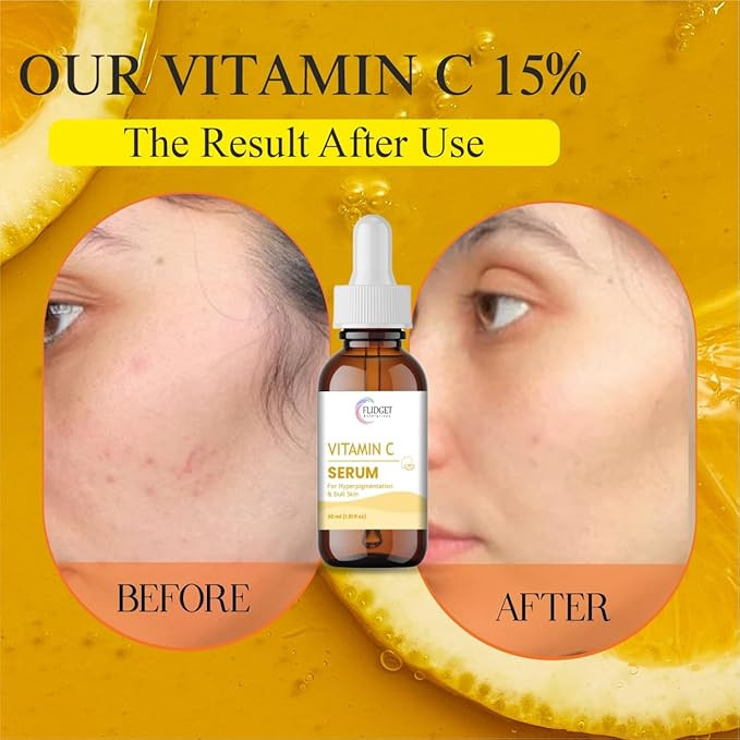 Vitamin C Serum for Hyperpigmentation and Dull Skin, 30ml Facial Treatment, Amber Glass Bottle with Dropper